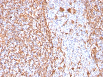 Recombinant Vimentin Antibody