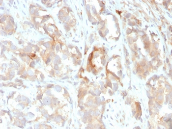 Cytokeratin 6B Antibody