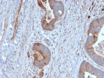 Cytokeratin 6B Antibody