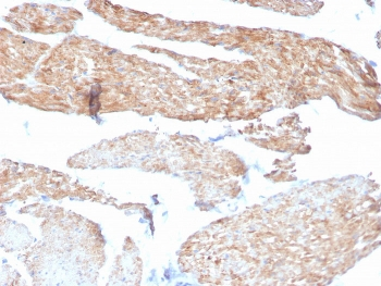 Aciculin Antibody / PGM5 / Phosphoglucomutase 5