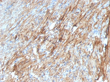 Fibronectin Antibody
