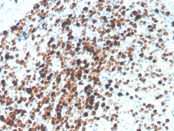 Recombinant TOP2A Antibody / Topoisomerase II alpha