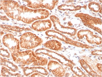 CA9 Antibody / Carbonic Anhydrase IX