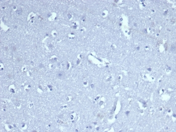 Recombinant CD8A Antibody
