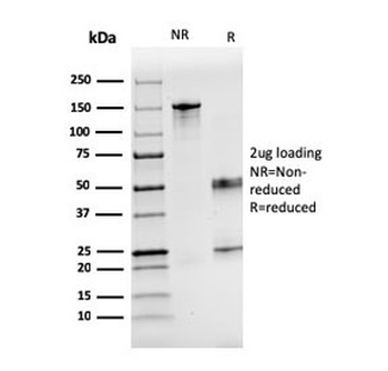 F7 Antibody / Factor VII
