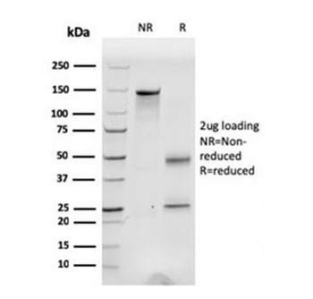 Fibronectin Antibody