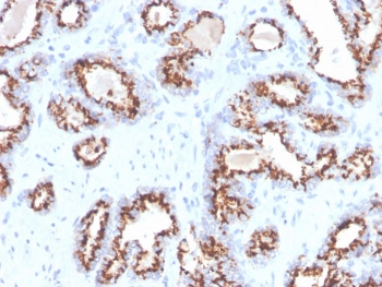 Recombinant Prostein Antibody / SLC45A3