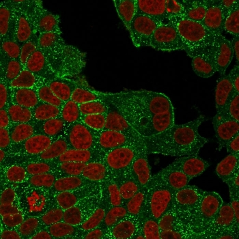 HER2 Antibody / ErbB2 / Extracellular region