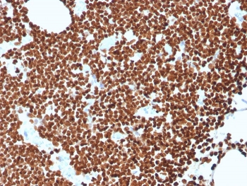 Recombinant dsDNA Antibody