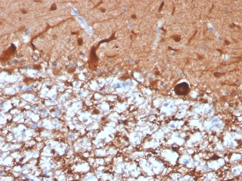 Recombinant PGP9.5 Antibody
