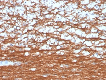 Recombinant PGP9.5 Antibody / UchL1
