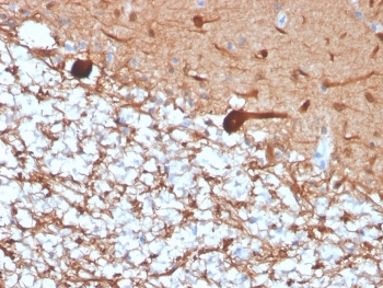 Recombinant PGP9.5 Antibody / UchL1