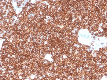 Recombinant CD4 Antibody