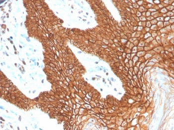 Recombinant E-Cadherin Antibody / CDH1
