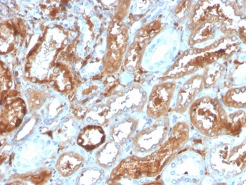 RBP4 Antibody / Retinol Binding Protein 4