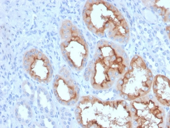 FGF23 Antibody / Fibroblast Growth Factor 23