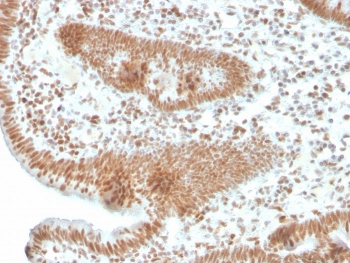 Recombinant PMS2 Antibody / PMS1 homolog 2