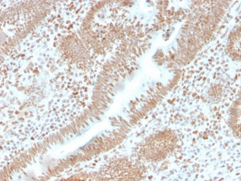 Recombinant PMS2 Antibody / PMS1 homolog 2