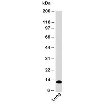 S100A8 Antibody