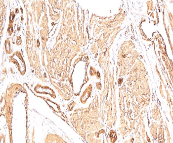 Smooth Muscle Actin Antibody