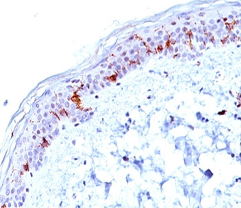 CD1a Antibody