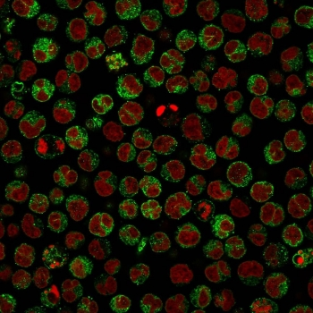 CD79a Antibody