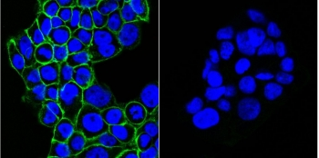 EGFR Antibody / EGF Receptor