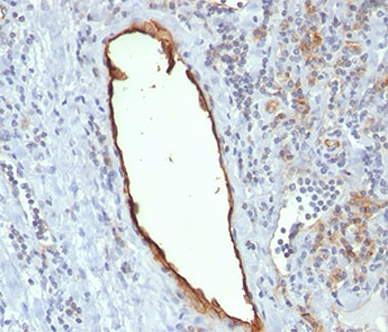 PECAM-1 Antibody / CD31