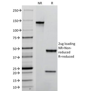 PECAM-1 Antibody / CD31