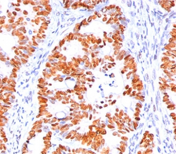 p53 Antibody (N-Terminal Region)