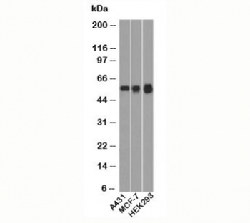 p53 Antibody (N-Terminal Region)