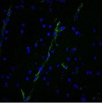 vWF Antibody / von Willebrand Factor