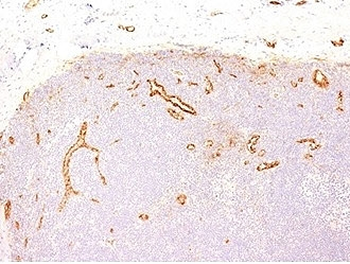 von Willebrand Factor Antibody