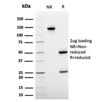 von Willebrand Factor Antibody