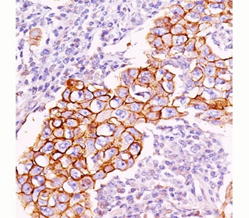 Phosphotyrosine Antibody