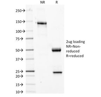 Phosphotyrosine Antibody