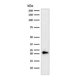 p21 Antibody Cocktail