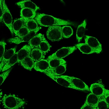 CCR5 Antibody