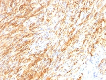 GFAP Antibody Cocktail