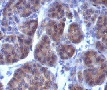 Golgi Marker Antibody / Golgi apparatus protein 1 / GLG1