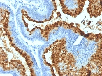 ABO Antibody (Blood Group Antigen B)