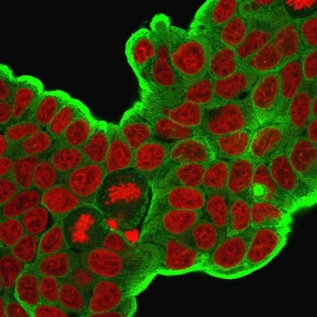 HSP27 Antibody