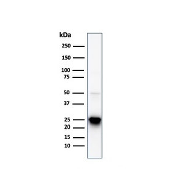 HSP27 Antibody