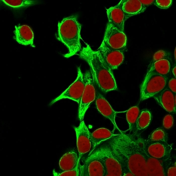 Cytokeratin 18 Antibody