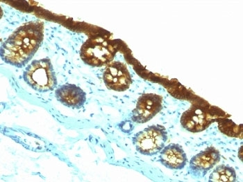 CK19 Antibody / Cytokeratin 19