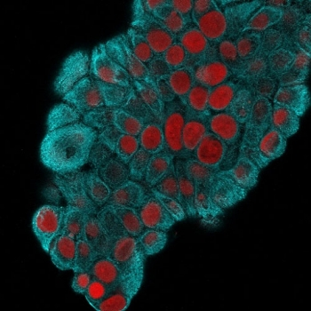 CK19 Antibody / Cytokeratin 19