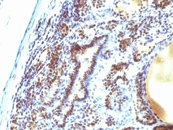 MAP3K1 Antibody