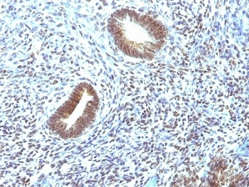 MAP3K1 Antibody