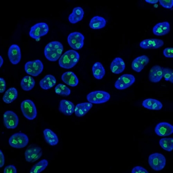Nucleolin Antibody