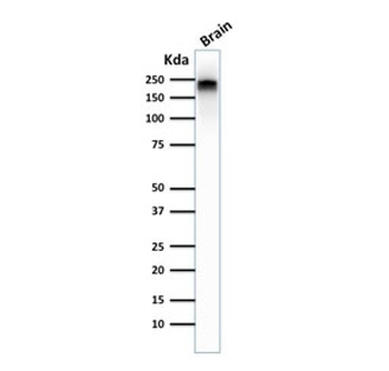 NF-H Antibody (phospho)